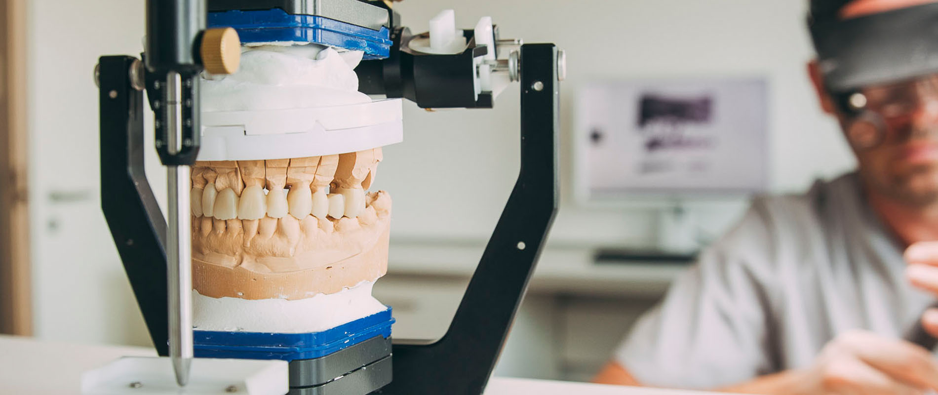 Eine keramische Brückenversorgung – Zahnersatz